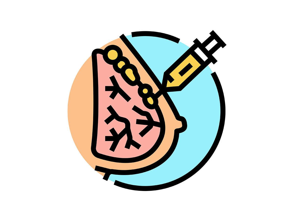 How Much Fat Is Needed for Successful Breast Augmentation